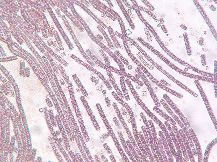 Microscope image of the species Planktothrix rubescens, responsible for the 2022 bloom in Lake Averno