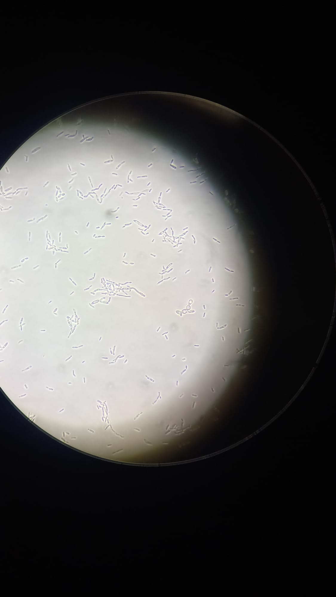 Immagine al microscopio ottico di lieviti oleaginosi. In particolari condizioni nutrizionali accumulano oli utilizzabili per formulazioni cosmetiche, plastificanti o biodiesel.